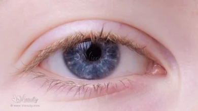7-reasons-why-your-eye-won' t-stop-twitching