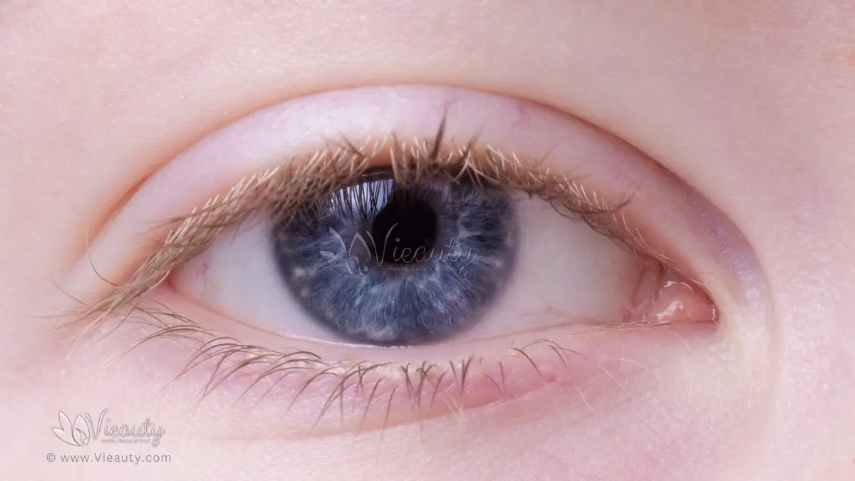 7-reasons-why-your-eye-won' t-stop-twitching